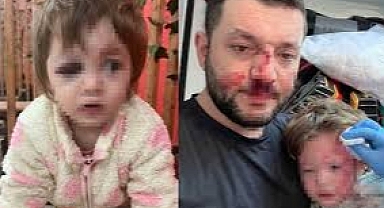 AKSAÇLILAR Genel Başkanı Ahmet Bereket “Yaşanan olayın toplum vicdanını derinden yaraladı